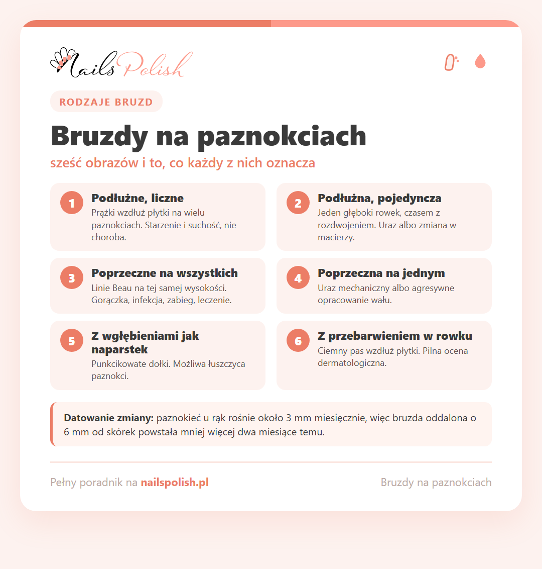 Infografika: rodzaje bruzd na paznokciach - podłużne, poprzeczne i ich prawdopodobne przyczyny