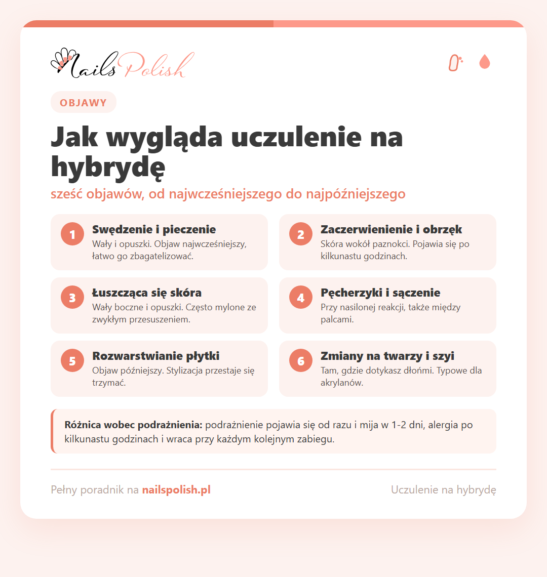 Infografika: objawy uczulenia na hybrydę - od swędzenia wałów po zmiany na twarzy