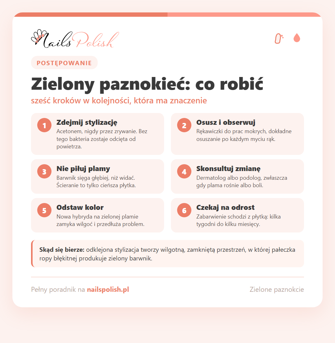 Infografika: zielony paznokieć pod hybrydą - sześć kroków postępowania